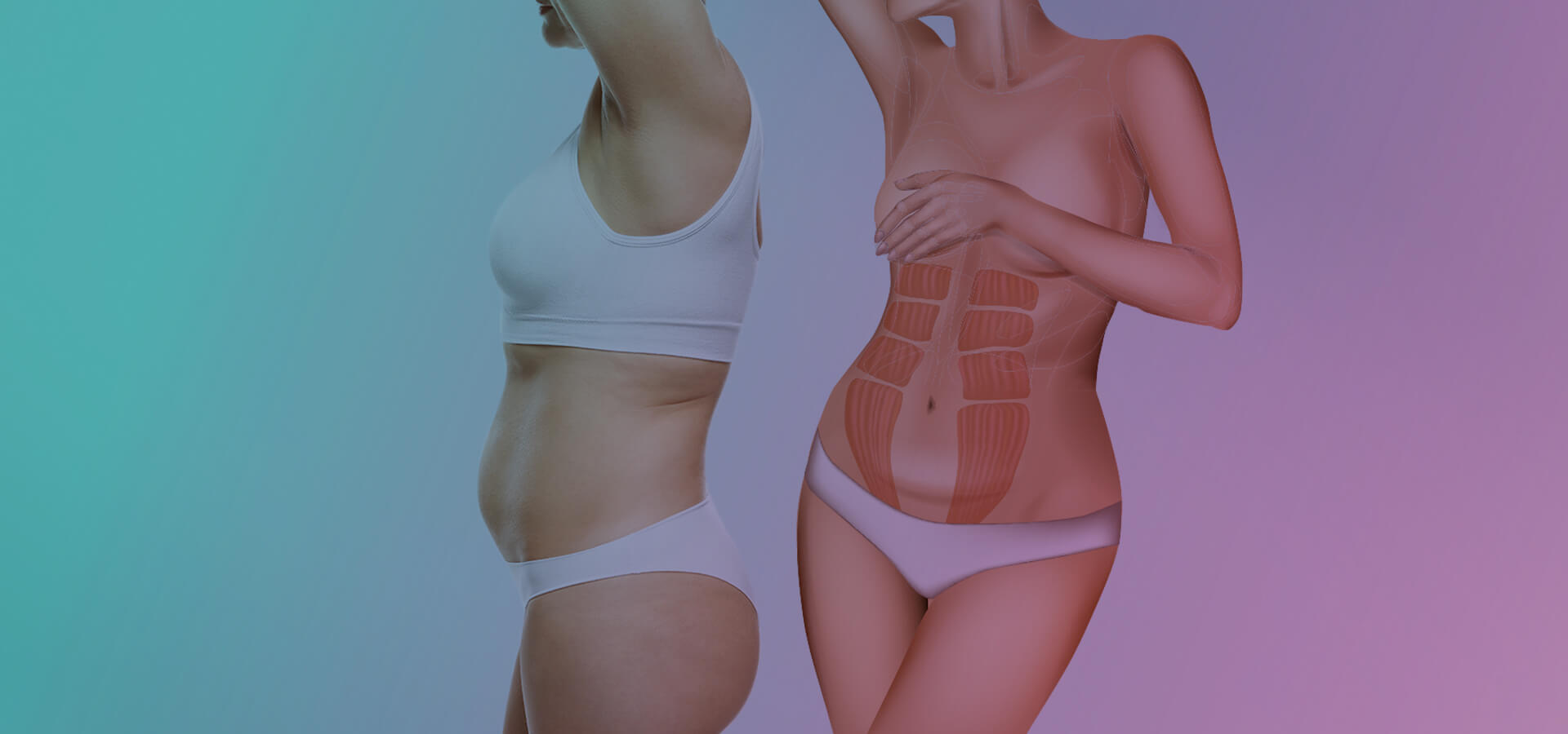 Diástasis abdominales